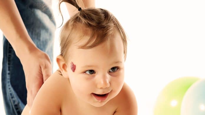 Emangiomi Infantili: Sintomi, Cause e Trattamenti